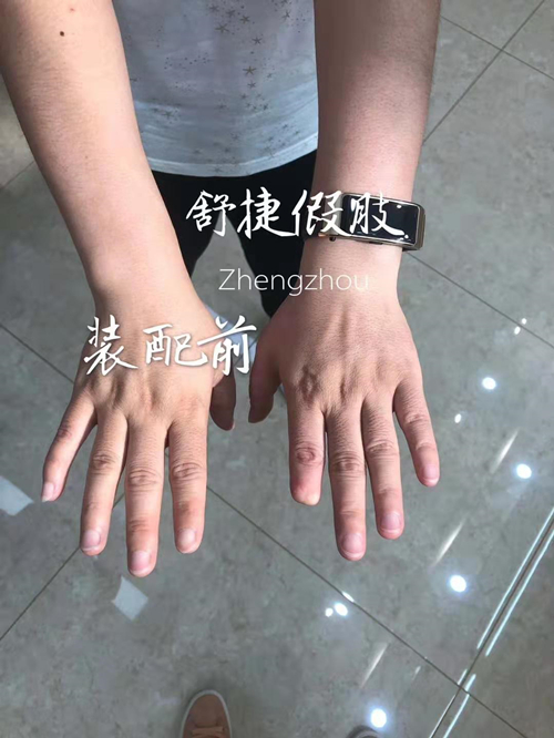假手指 假手指