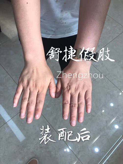 假手指 假手指
